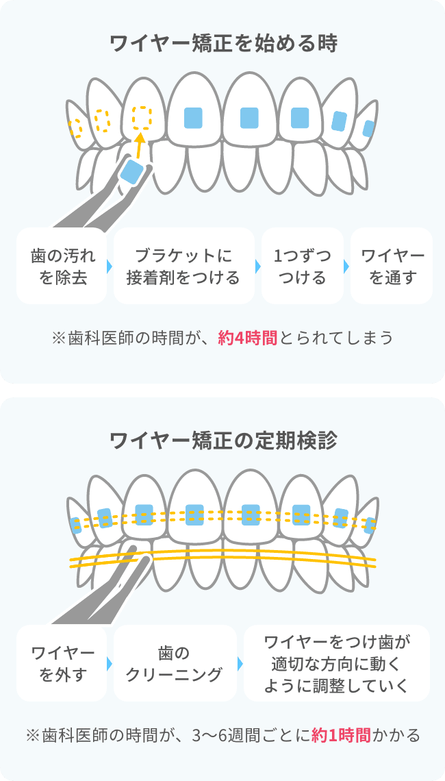 ワイヤー矯正の値段が高い理由