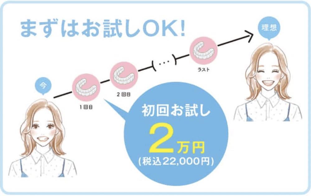 キレイライン矯正はお試し可能
