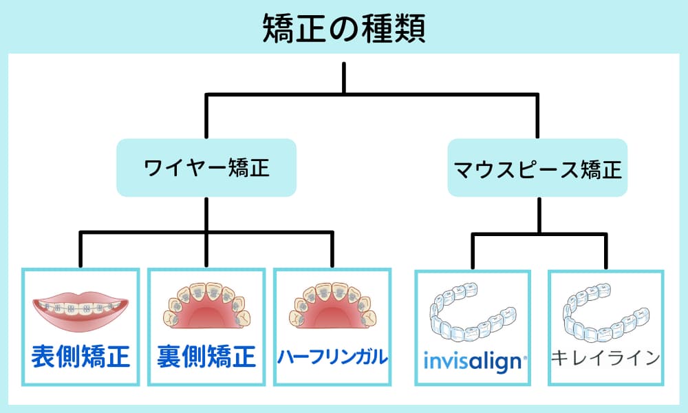 福岡市で安い 評判が良いおすすめな人気矯正歯科院 歯列矯正 マウスピース矯正の口コミも 歯科矯正の窓口