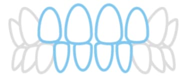 すきっ歯のイラスト