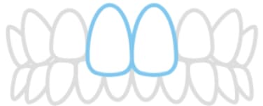 出っ歯のイラスト