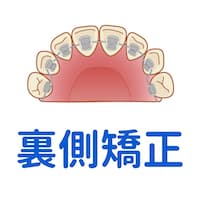 広島市でおすすめな矯正の種類②裏側矯正
