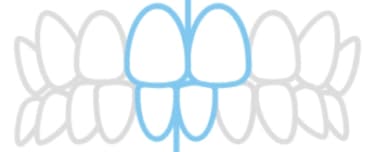 中心のずれのイラスト